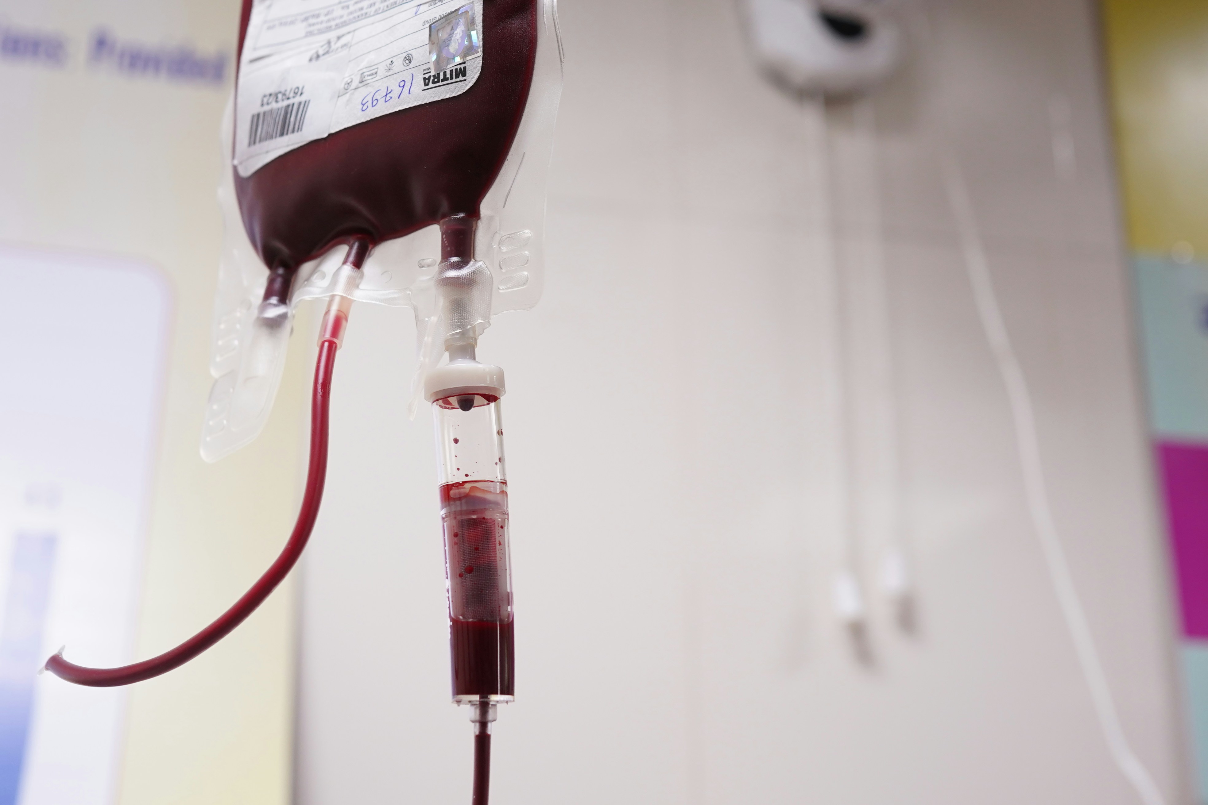 A bag of blood connected to a drip.