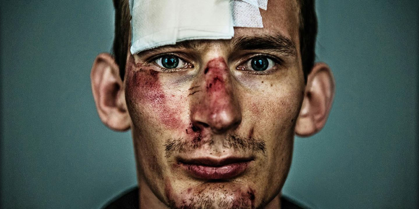 A close up of the face of a bruised and bloodied cyclist with a large bandage on his forehead.