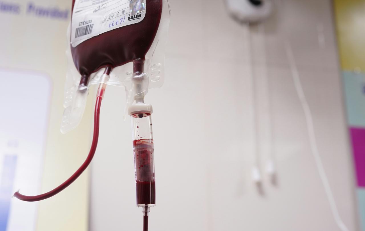 A bag of blood connected to a drip.